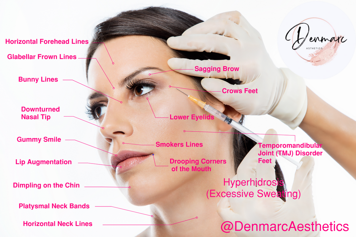 Different uses of Botox